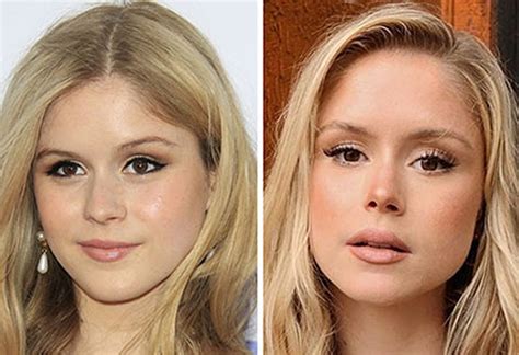 erin moriarty nudes|Erin Moriatry looks better after her plastic surgery work